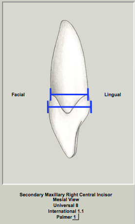 Mx Central Width Prox.png